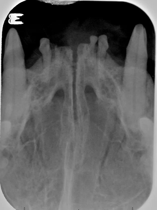 dental RTG